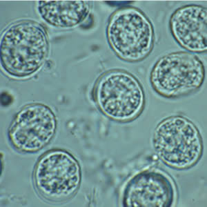 Microscope image of round cysts.